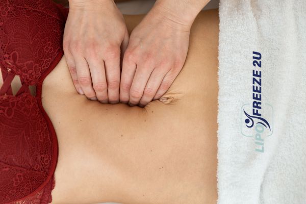 diastasis recti treatment Basildon