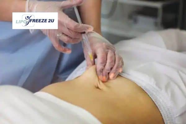 How Does Aqualyx Fat Dissolving Injection Work to Break Down Fat Basildon?