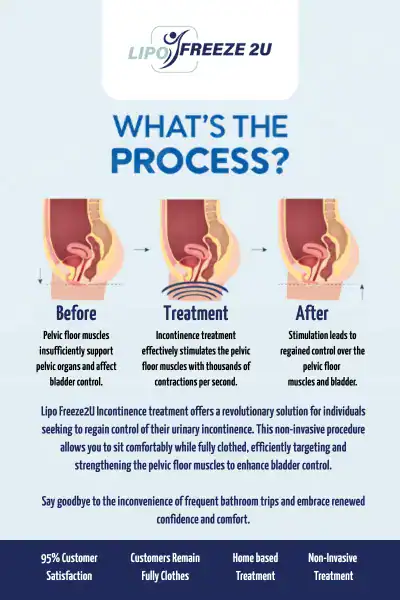 Diagram of how incontinence treatment Basildon works.