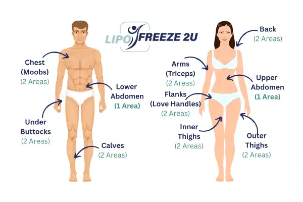 Areas you can have fat freezing treatment Basildon