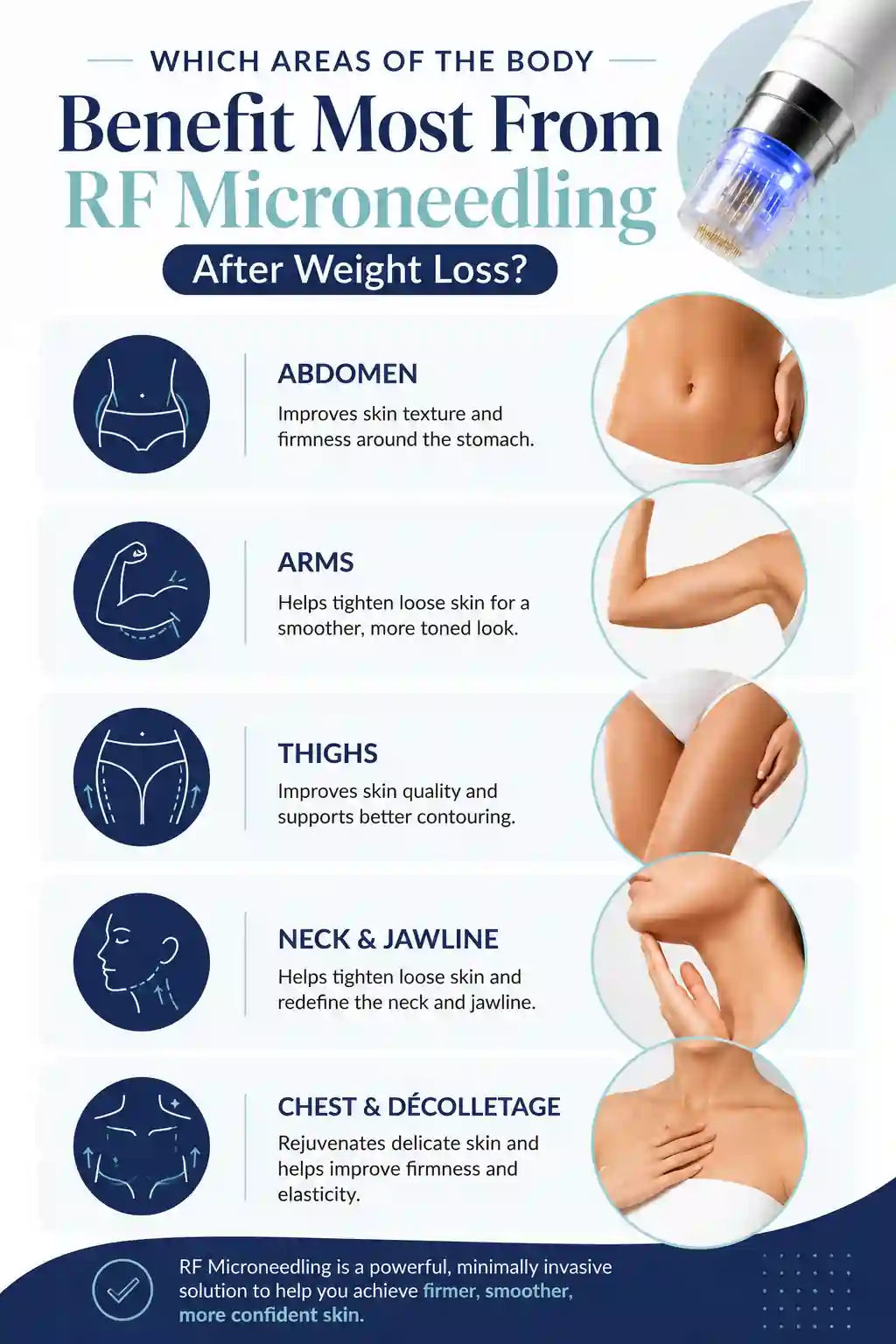 Which Areas of the Body Benefit Most From RF Microneedling After Weight Loss Basildon